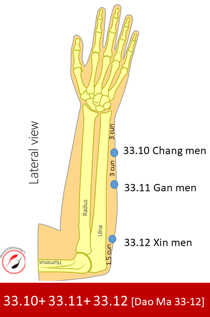 Acupuncture for Calf Trigger Points — Morningside Acupuncture NYC