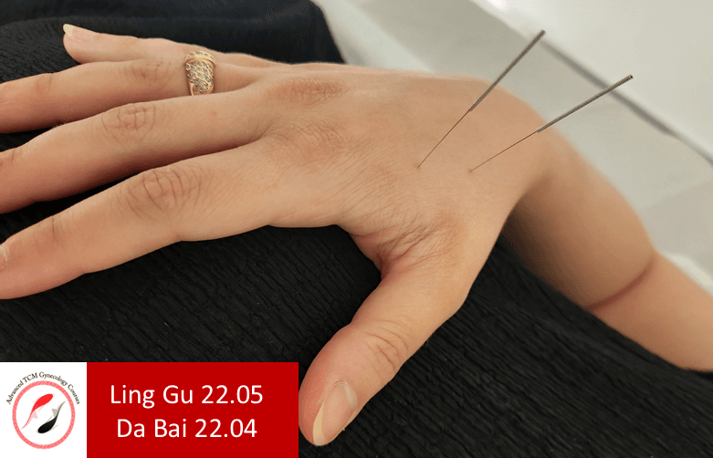 Master Tung Ling gu 22.05 Da bai 22.04